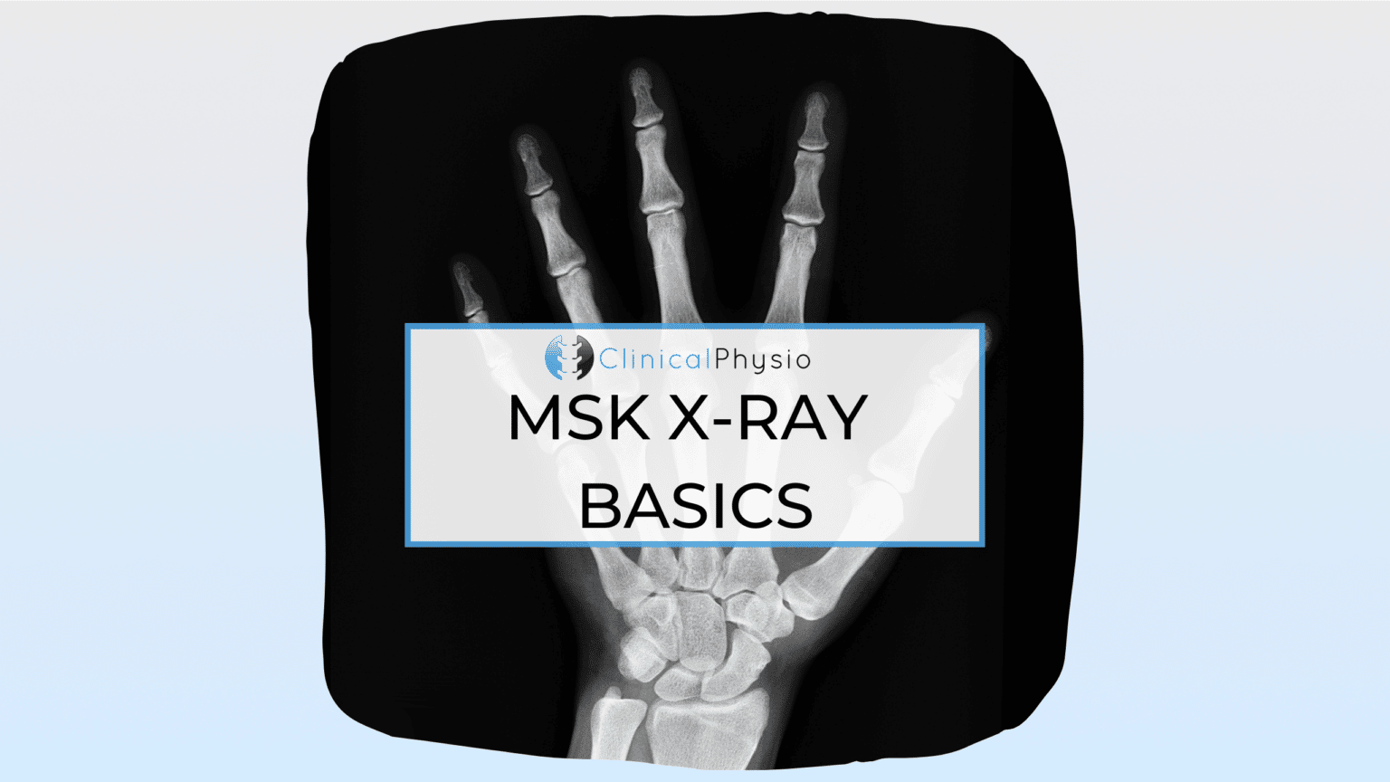 Musculoskeletal Xray Basics Clinical Physio Membership