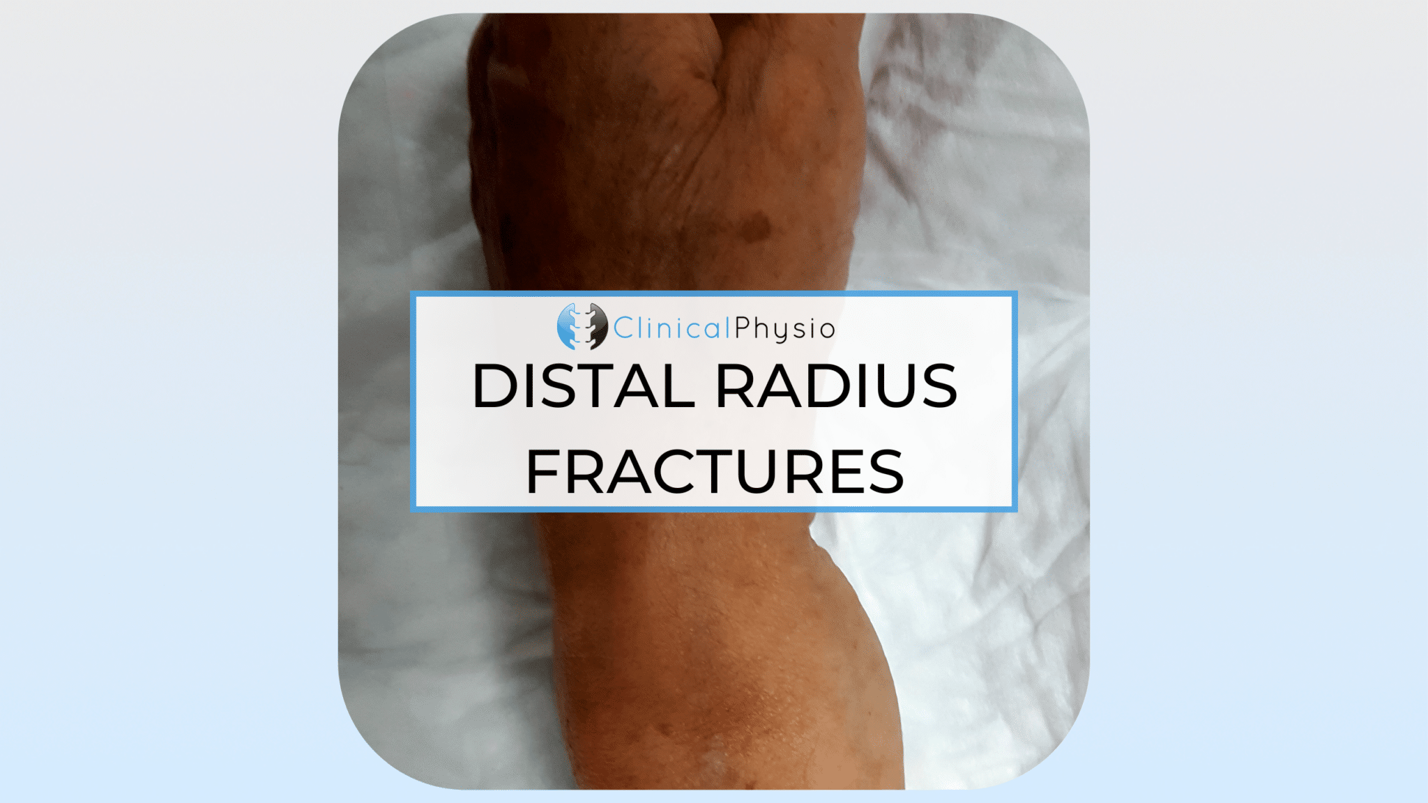 Distal Radius Fractures Clinical Physio Membership
