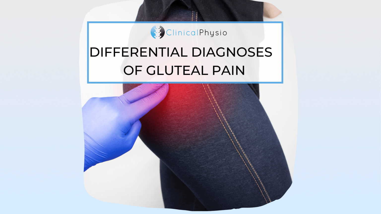 Differential Diagnoses of Gluteal Pain Clinical Physio Membership