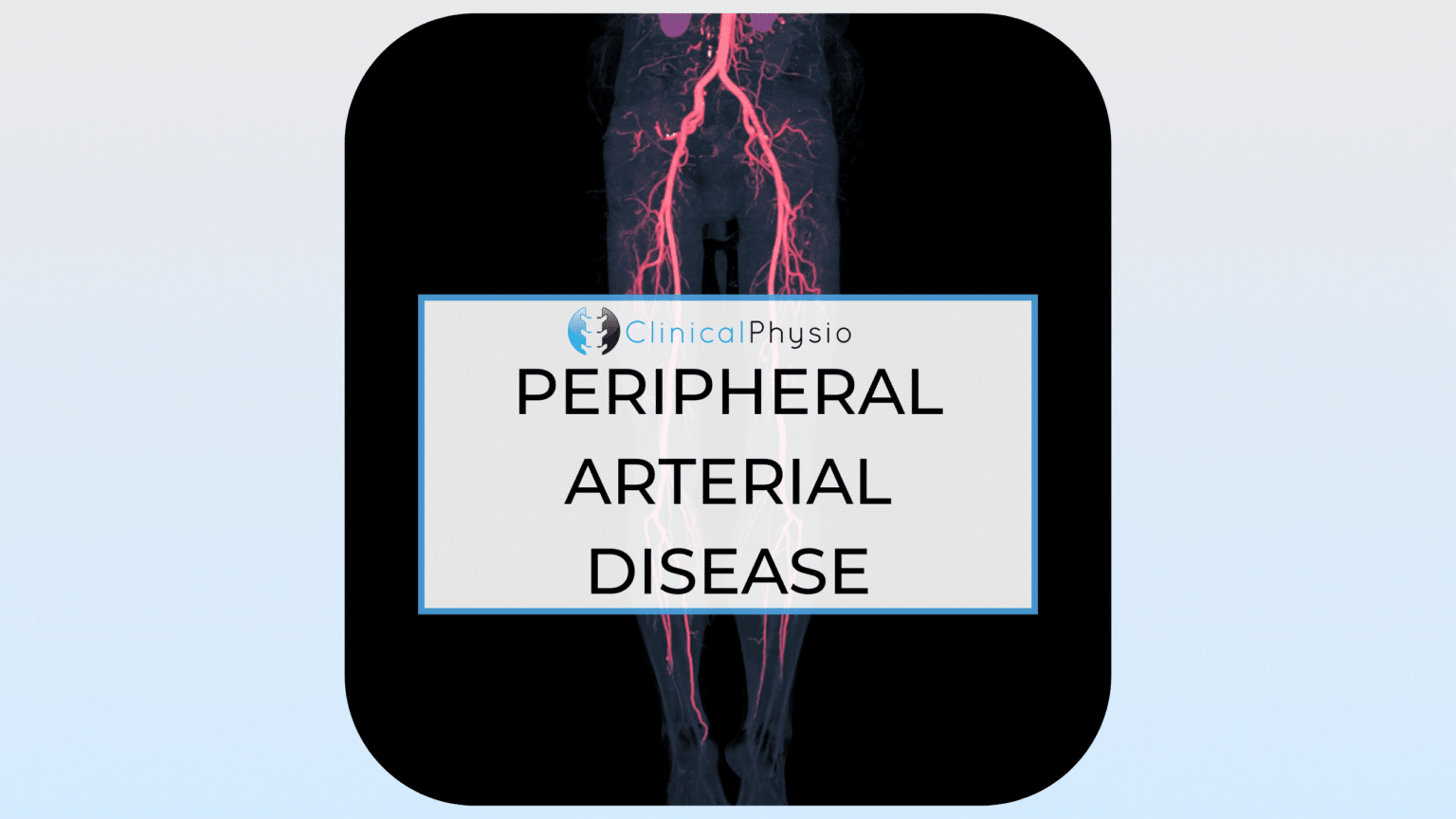 Peripheral Arterial Disease of the Lower Limb – Clinical Physio Membership